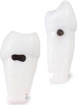DH M-Series Replacement Teeth w/SimCalc