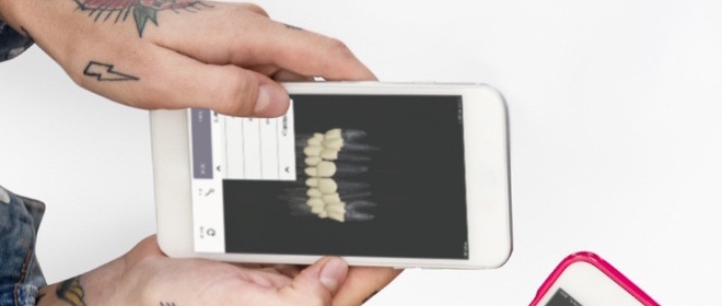 ToothView app screen